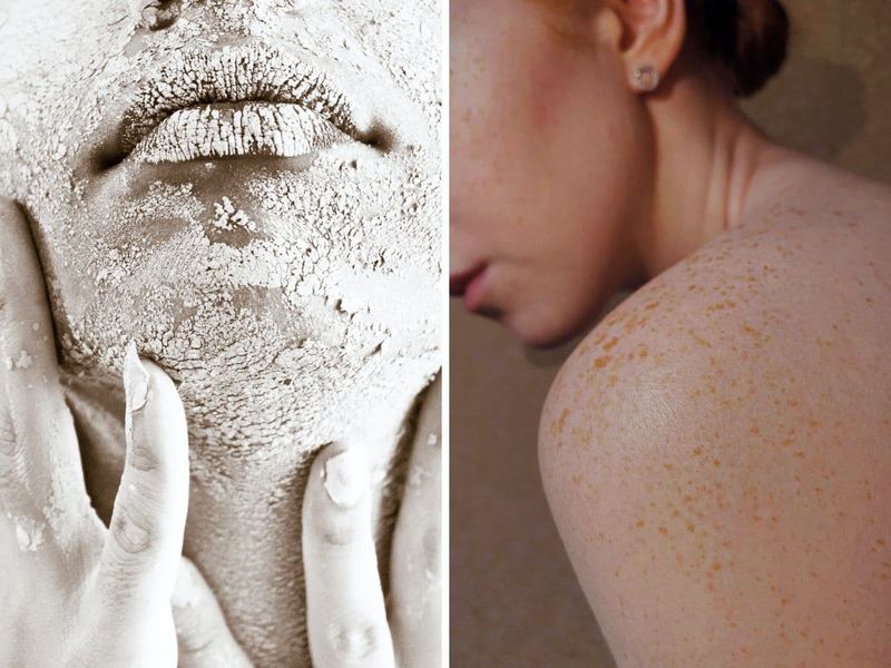Skin care for sensitive skin